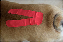 Kinesiologisches Taping